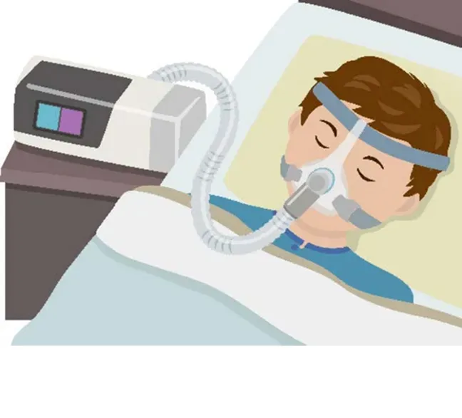 いびき・睡眠時無呼吸症候群に対するCPAP療法